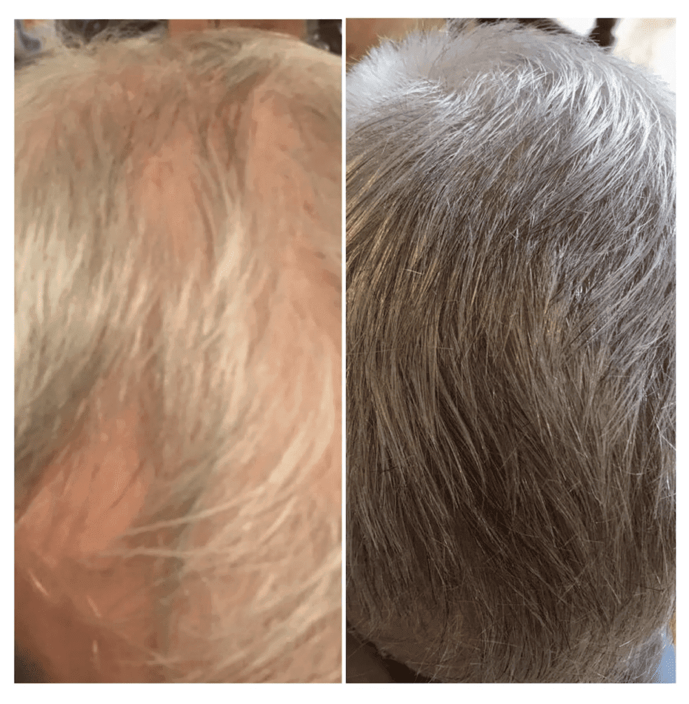 Visit The Headroom for Thinning Hair Solutions